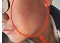 让女儿跪门口扇巴掌,女儿遭遇班主任扇耳光，脸都打肿了？