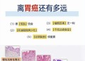 胃炎被当癌症切全胃,医生告知说3种胃病是癌前病变，哪3种？