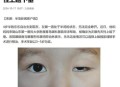 女婴眼睛小被挑剩下,女婴眼睛小,长长能变大吗