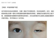 女婴眼睛小被挑剩下,女婴眼睛小,长长能变大吗