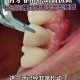 牙周炎一次拔14颗牙,牙周炎，牙齿松疼可以拔吗？