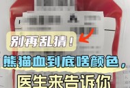 22年来首现小p血型,小p血型是什么血型