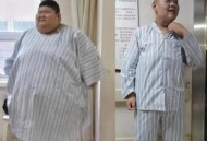 做切胃手术在ICU身亡,做切胃手术在icu身亡怎么办