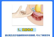 手掌受伤让查前列腺,按摩手掌哪个穴位可以治疗前列腺炎？