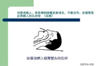 00后女孩自学插胃管,护理要学插胃管吗？