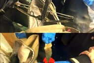 爱犬被射毒针致死,射杀狗的毒针有没有