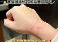 被40只狗围咬致死,被40只狗围咬致死案例
