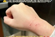 被40只狗围咬致死,被40只狗围咬致死案例