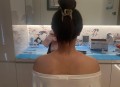 女子打瘦肩针险丧命,瘦肩针100单位有效果吗？