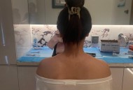 女子打瘦肩针险丧命,瘦肩针100单位有效果吗？