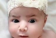 女婴眼睛小被挑剩下,宝宝的眼睛那里被碰肿了，该怎么处理？