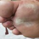 袜子塞鞋或诱发脚气,为什么穿地摊的袜子会臭脚气啊，是材料太糟糕了吗？