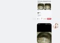 误吞勺子半年后发现,电饭煲乘粥的胶勺被油烫变形了了没有毒？