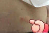 女子遭毒蛇咬伤身亡,女人掉下悬男人救结果被石头砸断了腰蛇在咬女人女人叫放手请是是什么意思？