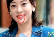 孙俪唇下痣没了,孙俪唇下痣是后来有的吗？