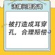被邻居扇脸鼓膜穿孔,被邻居扇脸鼓膜穿孔怎么赔偿