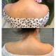 女子打瘦肩针险丧命,有打过瘦肩针的美女吗
