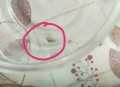 女童呕吐活虫一个月,孩子吐出来有活虫子