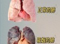 吸烟如何摧毁你的肺,吸烟对肺的影响有多大危害？