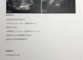 痛经去医院结果生了,孕晚期有大便和痛经感是快生了吗？