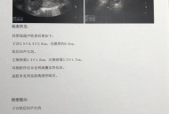 痛经去医院结果生了,孕晚期有大便和痛经感是快生了吗？
