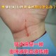 咬破手指写字求救,求助：一年内被猫咬两次，第二次还用打狂犬疫？