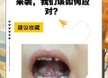 舌根和牙龈被缝一起,舌头根靠牙地方肿大怎么回事？