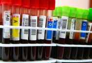 曝日研发万能型血浆,ab型是万能型吗？