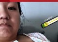摸到疙瘩确诊乳腺癌,乳腺癌肿块看着摸着什么样？