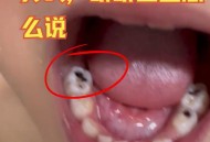 4岁娃全麻拔乳牙身亡,小朋友补牙可以走医保吗？