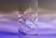 7岁男孩遭3只犬撕咬,狗狗三岁相当于人类多大？