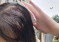 小孩被天降乌龟砸死,“悲剧之父”埃斯库罗斯是怎样死的？真的是被乌龟砸死的吗？