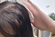 小孩被天降乌龟砸死,“悲剧之父”埃斯库罗斯是怎样死的？真的是被乌龟砸死的吗？