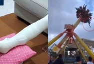 	游乐园摆锤断裂23伤,游乐场摆锤事故