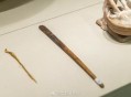 大爷体内藏52年牙刷,