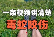 每年超25万人被蛇咬,每年超25万人被蛇咬死