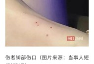 每年超25万人被蛇咬,澳大利亚蛇多吗？