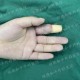 被断4根手指已恢复,被断4根手指已恢复怎么办