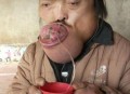 患怪病身体疼20余年,有个人得了怪病，肚脐眼疼，医院检查又查不到问题，究竟什么病？