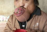 患怪病身体疼20余年,有个人得了怪病，肚脐眼疼，医院检查又查不到问题，究竟什么病？