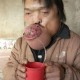 患怪病身体疼20余年,有个人得了怪病，肚脐眼疼，医院检查又查不到问题，究竟什么病？