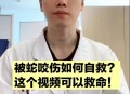 被蛇咬伤网友救命,蛇认出救命恩人的故事？