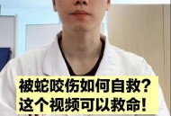 被蛇咬伤网友救命,蛇认出救命恩人的故事？