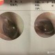 被邻居扇脸鼓膜穿孔,老师把学生打成鼓膜穿孔就怎么办？