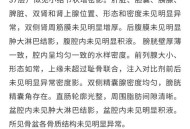 医生误做腹超被停工,医生误做腹超被停工怎么赔偿