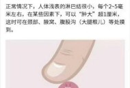 摸到疙瘩确诊乳腺癌,乳腺癌能摸出来有疙瘩吗