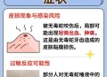 被蛇咬反抓蛇再遭咬,为什么农夫救蛇反被蛇咬？