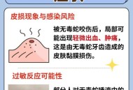 被蛇咬反抓蛇再遭咬,为什么农夫救蛇反被蛇咬？