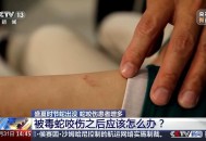 宝宝被蝮蛇咬伤,宝宝被蝮蛇咬伤怎么办