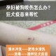 车被狗啃到面目全非,跳蚤咬后奇痒无比，反复发作怎么办?已经被抓的面目全非了？